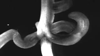 Planaria from our lab Thumbnail