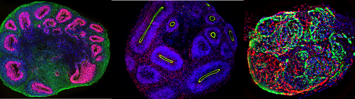 drei eingefärbte Organoide unter dem Mikroskop