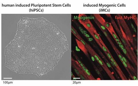Development of a cell therapy concept based on the generation of human induced Pluripotent Stem Cells (hiPSCs) and their differentiation into induced myogenic cells