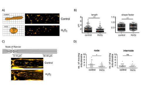 Effects of oxidative stress on morphology and motility of axonal mitochondria
