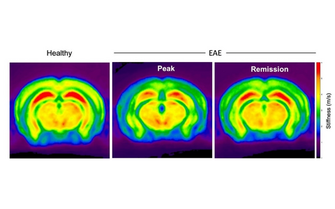 MR-Elasticity maps of healthy and EAE brains