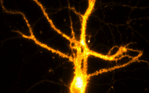 Total internal reflection fluorescence microscopy reveals the activity of primary hippocampal neurons. Data was acquired by Dr. Zohreh Farsi.