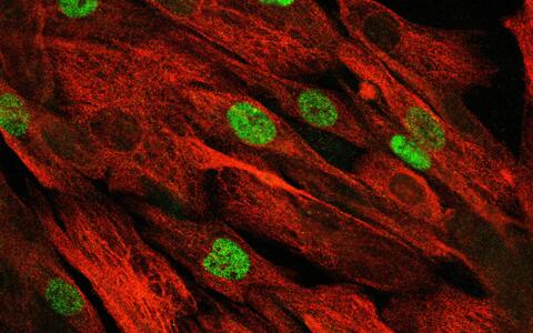 mikroskopische Aufnahme von Muskelstammzellen