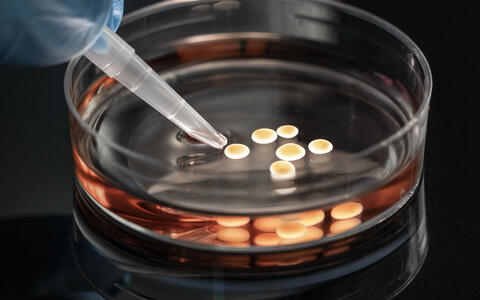 Human neuromuscular organoids generated from induced pluripotent stem cells by Mina Gouti Lab, MDC