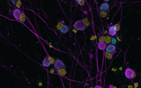 Human Neurons