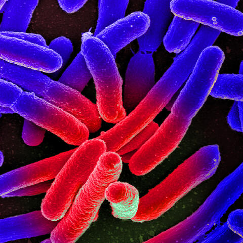 Escherichia coli under the microscope