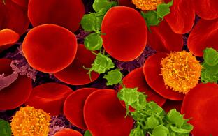 Human blood with red blood cells, T cells (orange) and platelets (green)