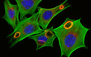 Fibroblasten, die mit Wachstumsfaktoren stimuliert wurden