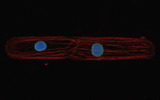 Hochauflösende mikroskopische Aufnahme einer einzelnen Herzmuskelzelle in welcher ein herzmuskelspezifisches Gen (TNNT2) sowie eine spezifische Kernfärbung zu sehen ist.