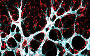 Growing blood vessel network in mouse retina