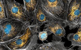 cow cells taken with a microscope. the mitochondria were stained in bright yellow to visualize them in the cell. The large blue dots are the cell nuclei and the gray web is the cytoskeleton of the cells.