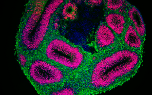 Scientific image of a brain organoid