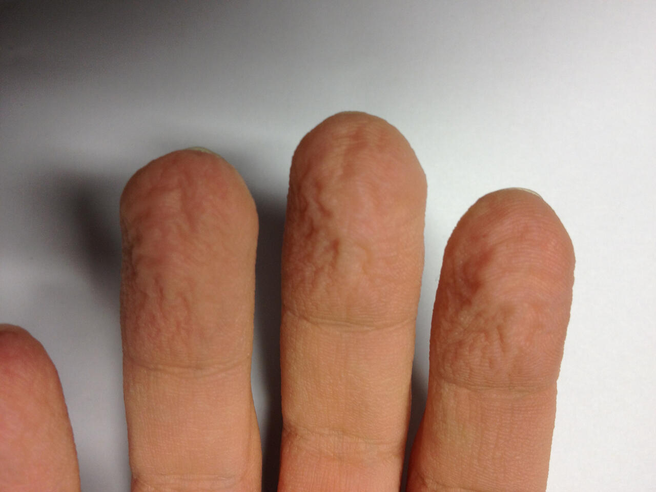 Better Grip With Wrinkly Fingers Mdc Researchers Find No Proof Mdc 